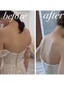 【挙式直前もOK】天使の羽＆華奢肩すっきり！背中・脇肉集中30分スピード痩身
