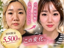 ソワラ 札幌