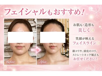 スノードロップ(Snowdrop)の写真/ホウレイ線/たるみ改善は土台から♪歪み/姿勢を整えて笑顔が映える印象に☆豊富なメニューから選べます★