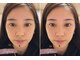 アネラアイラッシュ(ANELA eyelash)の写真
