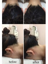 ドリームローズ(Dream Rose)/美肌脱毛