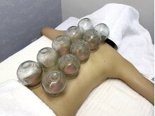 ぬくもり/カッピング