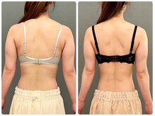 カナエルサロン 旭川(KANAERU SALON)/【ダイエット】症例☆