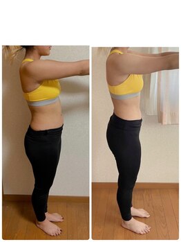 ザ スター(the STAR)/3ヶ月ビフォーアフター★