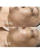 サロンディア(SALON Dea)/施術効果