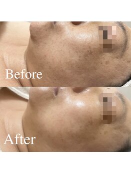 サロンディア(SALON Dea)/施術効果