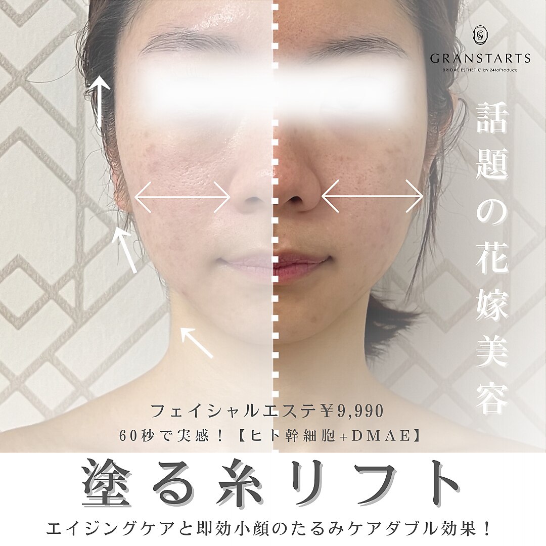 こばみぃ様 専用ページ