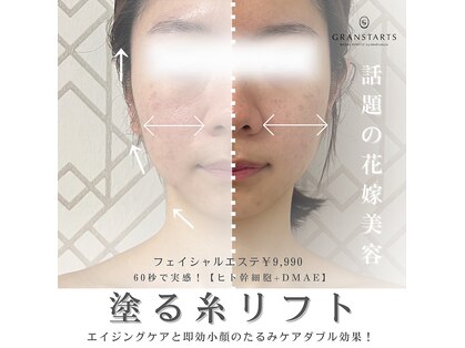 グランスターツ(GRANSTARTS)の写真