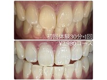 ホワイトニングルーム 横浜店(Whitening Room)/ホワイトニング/横浜