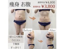 ペルラペティーユ(PERLA PETILLER)