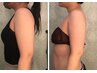 二の腕引き締め集中＋脂肪冷却で理想の腕に¥21000→¥18000