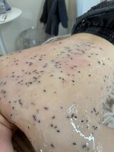 ハレモアナ(HALE MOANA)/背中WAX・ハイドロ