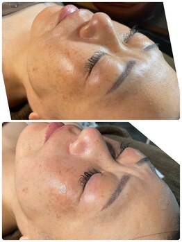 グランヴェルデ(GRAND VERDE)/1回で肌印象が激変。