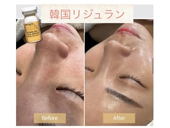 ジョイアビューティー(Gioia beauty)/話題のサーモンDNA!韓国水光肌へ