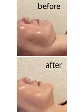 リリィ(RIRY)/フェイシャル 50代