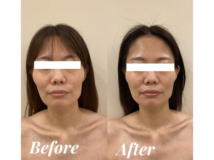 シェリール(Cherir)の写真