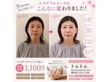トム トム