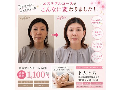 トム トムの写真