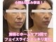 アディス 心斎橋(ADISE)の写真/見た目年齢ー10歳♪小顔とたるみへ徹底アプローチ◎年齢からくる肌悩みに寄り添い丁寧にケア◎