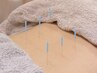 【全身調整！】気になる部位が多い方に◎鍼施術+ボディケア　80分¥7000