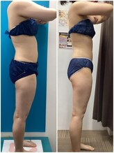 プリマプリート 各務原店/セラピス結果写真