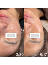 サロン サルー(SALON Salud)/◇再生美容