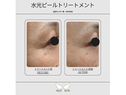 アンジュロワールの写真