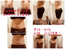 脱毛メリーの雰囲気（特許取得のＷキャビテーション・目に見える圧倒的な効果。）