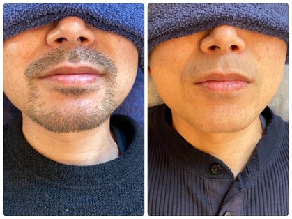 メンズ プラス アルファ(Mens plus a+)の写真