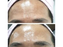 ウェリナベル(WelinaBelle)/ララピール