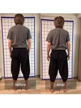 リアン 目黒駅(Re-Ane)/ビフォーアフター　股関節の痛み