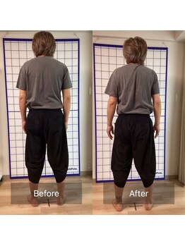リアン 目黒駅(Re-Ane)/ビフォーアフター　股関節の痛み