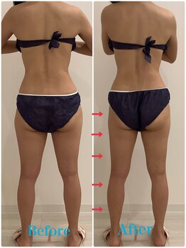 スペチアーレ 夙川/脚長効果抜群