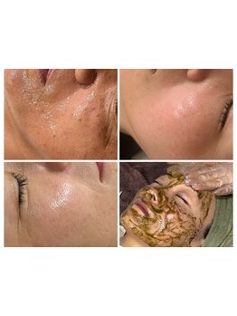 ハリツヤをUPしたい