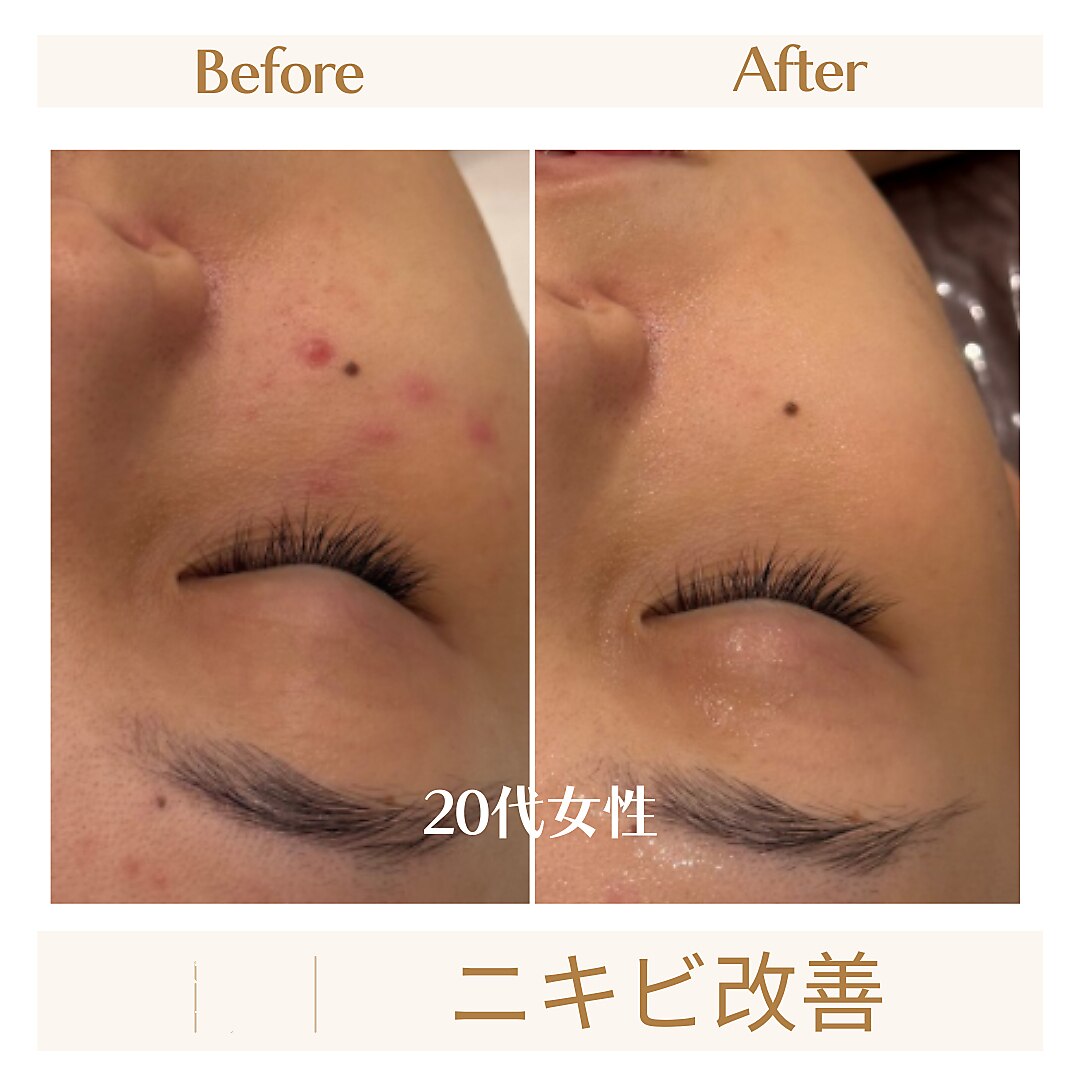 スカーレット 北参道(Scarlett)｜ホットペッパービューティー