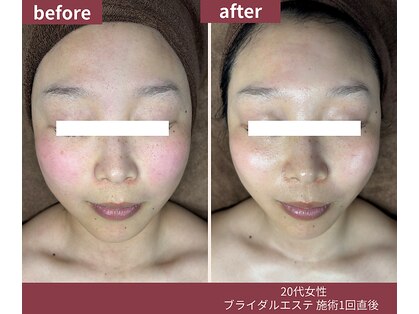ウェルネス ステーション リンク(Wellness Station Link)の写真