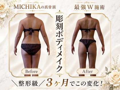 ミチカ(MICHIKA)の写真