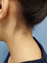 キアラ 麻布十番(Kiara)/うなじ脱毛ブラジリアンワックス