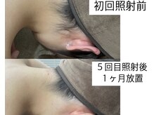 テンパ ビューティー(+10%beauty)/効果写真