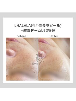 ポムハヌル(pom.haneul)/韓国肌管理室