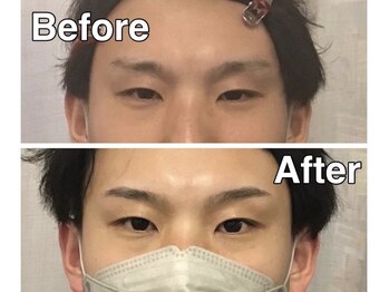 スター 新宿 新宿御苑(★STAR)/施術例メンズ眉毛WAX/新宿