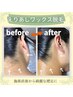 うなじ美人☆ワックス脱毛【初回お試し】2,200円