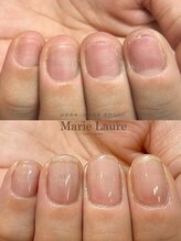 マリーロール 梅田店(Marie Laure)/自爪育成/深爪矯正/ネイルケア