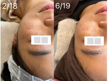 サロン サルー(SALON Salud)/◇再生美容