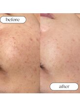 トータルビューティーサロンリア(Li'a)/ビフォー＆アフター