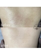 プライベートサロン コットン(COTTON)/ボディピーリング