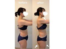 腰の浮き輪肉、お尻の下の脂肪　温めて流してスッキリと♪