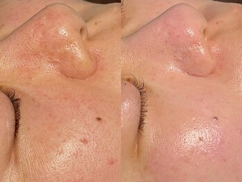 ルーナジェーナ(Luna llena)/池袋/目白/雑司ヶ谷/エステ