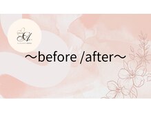 チャームアイ 札幌店(charm ai)/before/ after
