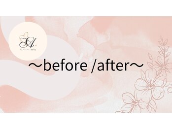 チャームアイ 札幌店(charm ai)/before/ after